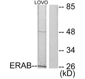 Western Blot - Anti-ERAB Antibody (C0183) - Antibodies.com