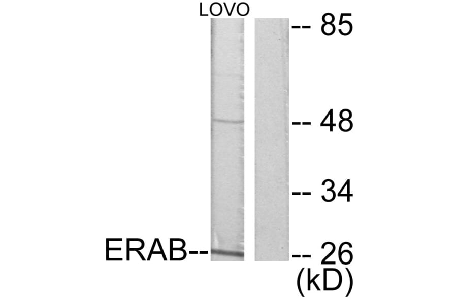 Western Blot - Anti-ERAB Antibody (C0183) - Antibodies.com