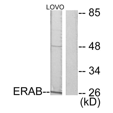 Western Blot - Anti-ERAB Antibody (C0183) - Antibodies.com