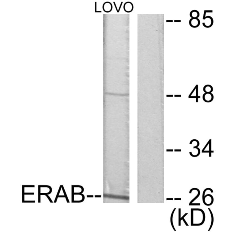 Western Blot - Anti-ERAB Antibody (C0183) - Antibodies.com