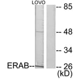 Western Blot - Anti-ERAB Antibody (C0183) - Antibodies.com