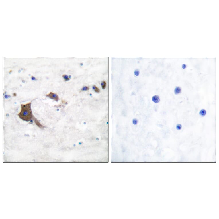Immunohistochemistry - Anti-ERAB Antibody (C0183) - Antibodies.com