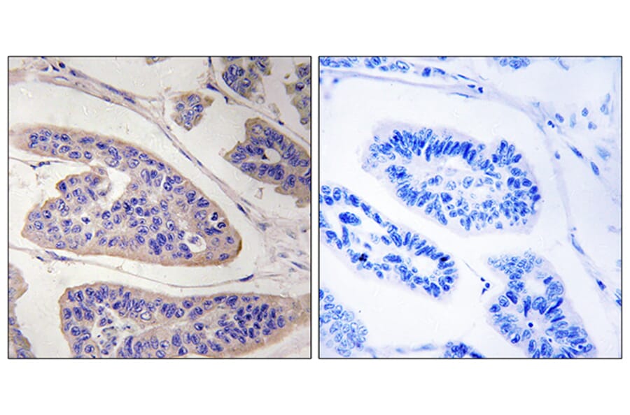 Immunohistochemistry - Anti-ENAH Antibody (C17988) - Antibodies.com