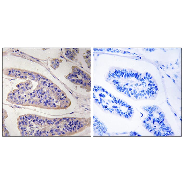 Immunohistochemistry - Anti-ENAH Antibody (C17988) - Antibodies.com