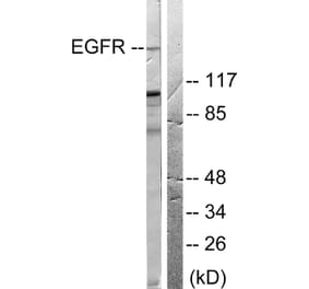 Western Blot - Anti-EGFR Antibody (B0008) - Antibodies.com