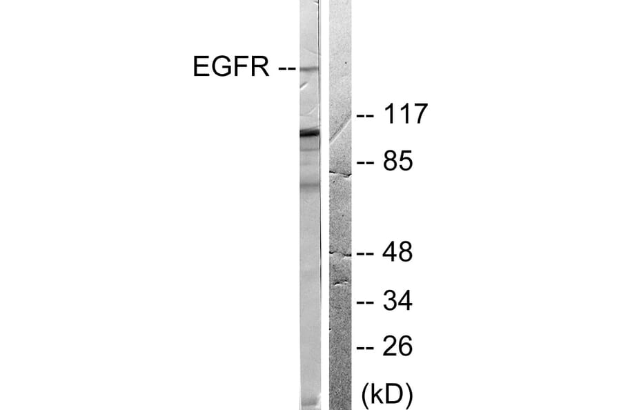 Western Blot - Anti-EGFR Antibody (B0008) - Antibodies.com