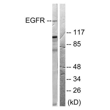 Western Blot - Anti-EGFR Antibody (B0008) - Antibodies.com