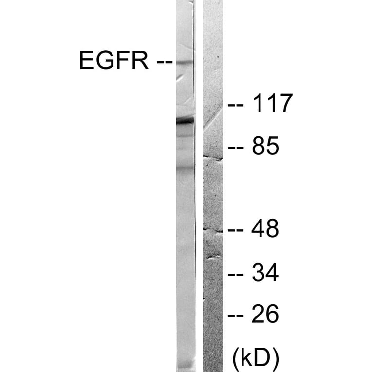 Western Blot - Anti-EGFR Antibody (B0008) - Antibodies.com