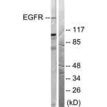 Western Blot - Anti-EGFR Antibody (B0008) - Antibodies.com