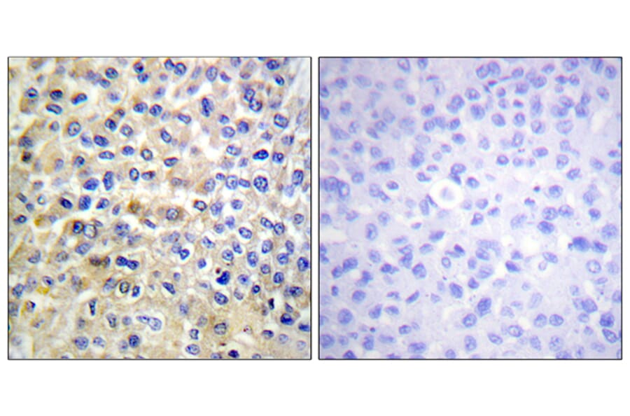 Immunohistochemistry - Anti-EGFR Antibody (B0008) - Antibodies.com
