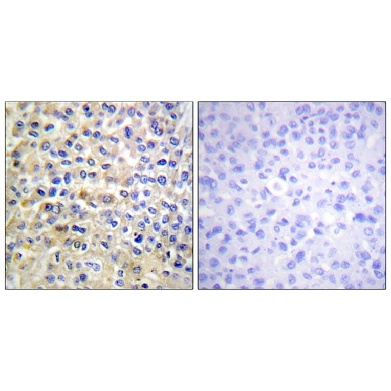 Immunohistochemistry - Anti-EGFR Antibody (B0008) - Antibodies.com