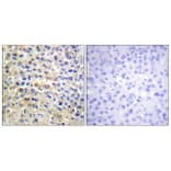 Immunohistochemistry - Anti-EGFR Antibody (B0008) - Antibodies.com