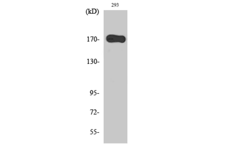 Western Blot - Anti-EGFR Antibody (B0008) - Antibodies.com