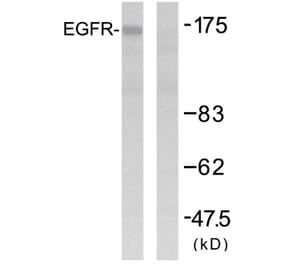 Western Blot - Anti-EGFR Antibody (B7061) - Antibodies.com