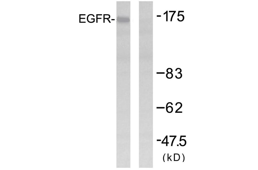 Western Blot - Anti-EGFR Antibody (B7061) - Antibodies.com