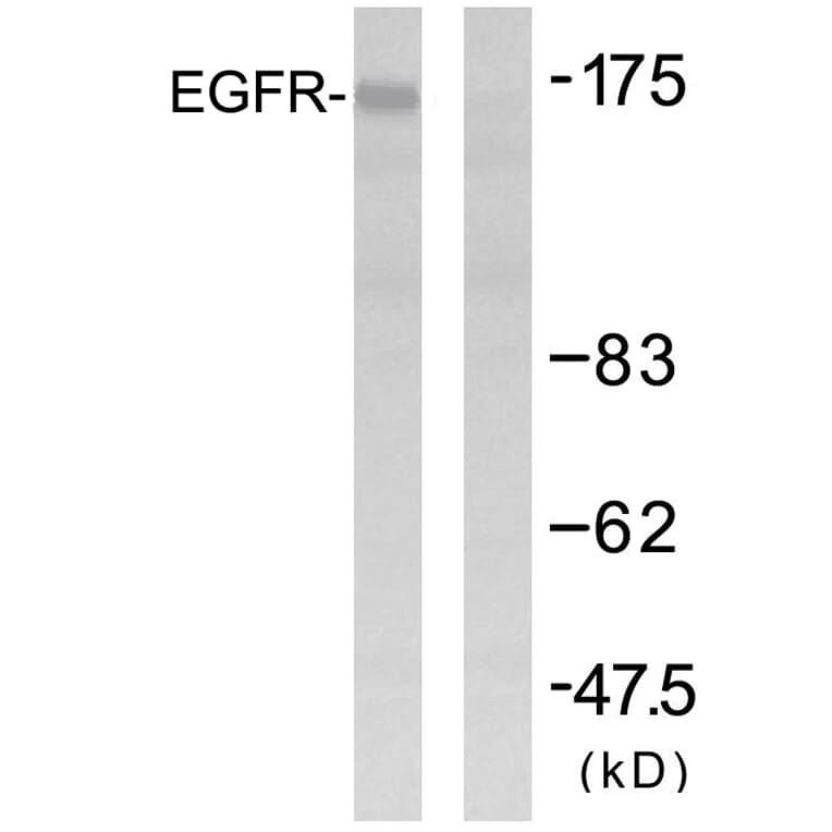 Western Blot - Anti-EGFR Antibody (B7061) - Antibodies.com