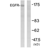 Western Blot - Anti-EGFR Antibody (B7061) - Antibodies.com