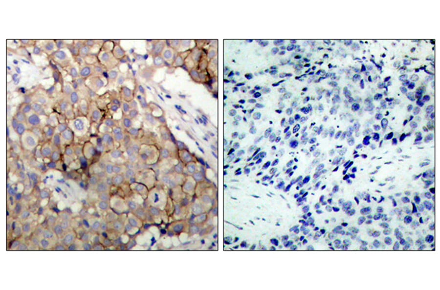 Immunohistochemistry - Anti-EGFR Antibody (B7061) - Antibodies.com