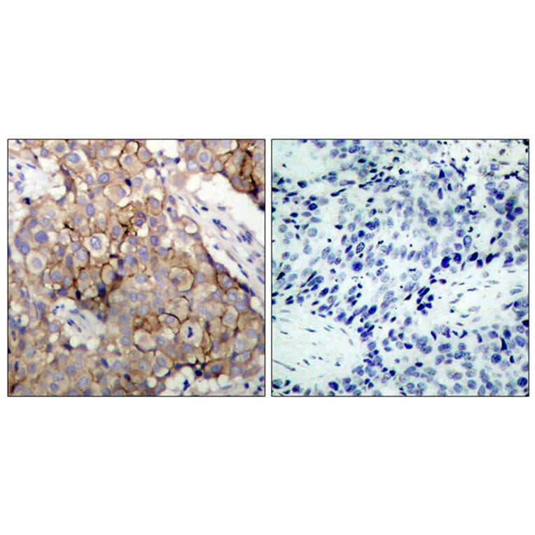 Immunohistochemistry - Anti-EGFR Antibody (B7061) - Antibodies.com