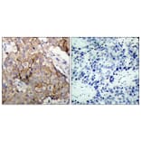 Immunohistochemistry - Anti-EGFR Antibody (B7061) - Antibodies.com