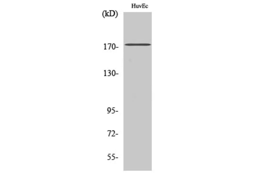 Western Blot - Anti-EGFR Antibody (B7061) - Antibodies.com