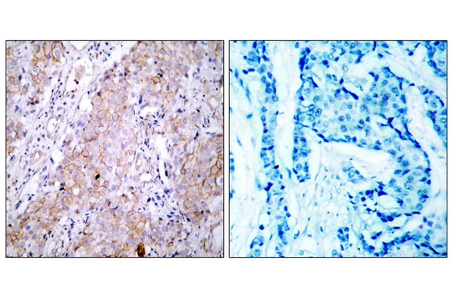 Immunohistochemistry - Anti-EGFR Antibody (B7060) - Antibodies.com