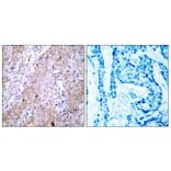 Immunohistochemistry - Anti-EGFR Antibody (B7060) - Antibodies.com