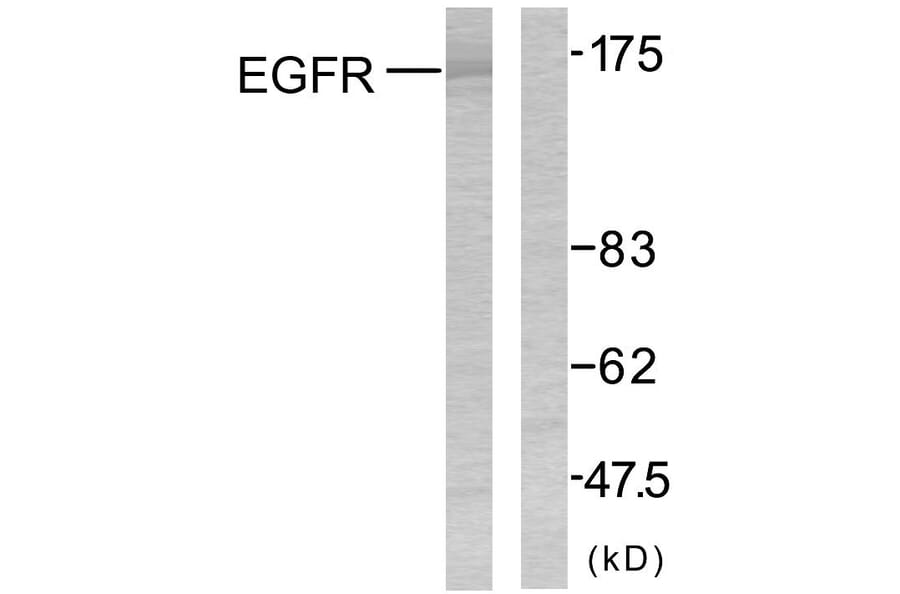 Western Blot - Anti-EGFR Antibody (B7060) - Antibodies.com