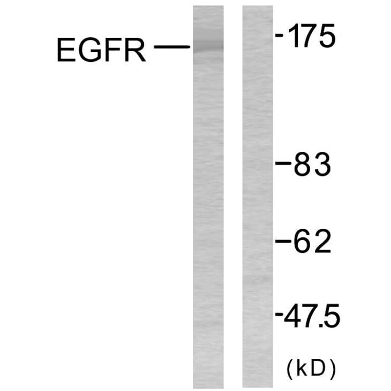 Western Blot - Anti-EGFR Antibody (B7060) - Antibodies.com