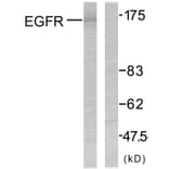 Western Blot - Anti-EGFR Antibody (B7060) - Antibodies.com