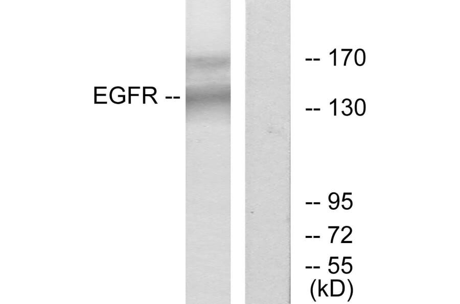Western Blot - Anti-EGFR Antibody (B7063) - Antibodies.com