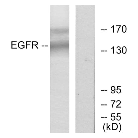 Western Blot - Anti-EGFR Antibody (B7063) - Antibodies.com