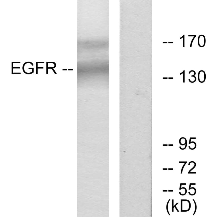 Western Blot - Anti-EGFR Antibody (B7063) - Antibodies.com