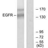 Western Blot - Anti-EGFR Antibody (B7063) - Antibodies.com