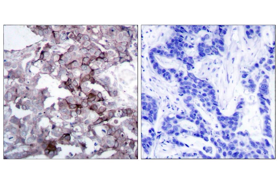 Immunohistochemistry - Anti-EGFR Antibody (B7063) - Antibodies.com