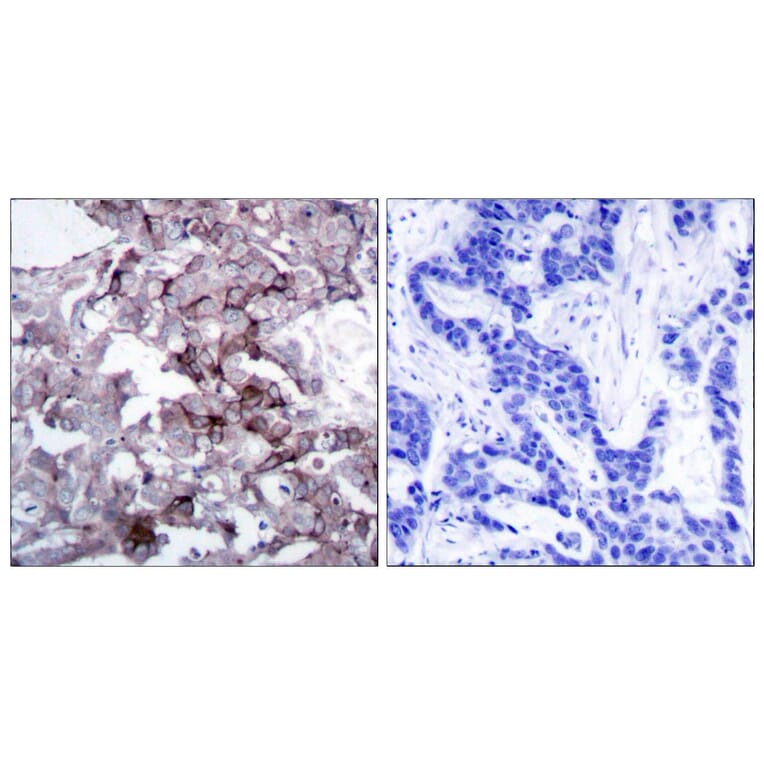 Immunohistochemistry - Anti-EGFR Antibody (B7063) - Antibodies.com