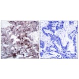 Immunohistochemistry - Anti-EGFR Antibody (B7063) - Antibodies.com