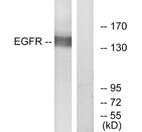 Western Blot - Anti-EGFR Antibody (B7065) - Antibodies.com