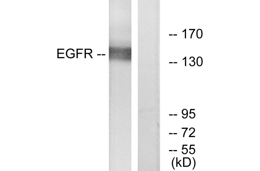 Western Blot - Anti-EGFR Antibody (B7065) - Antibodies.com