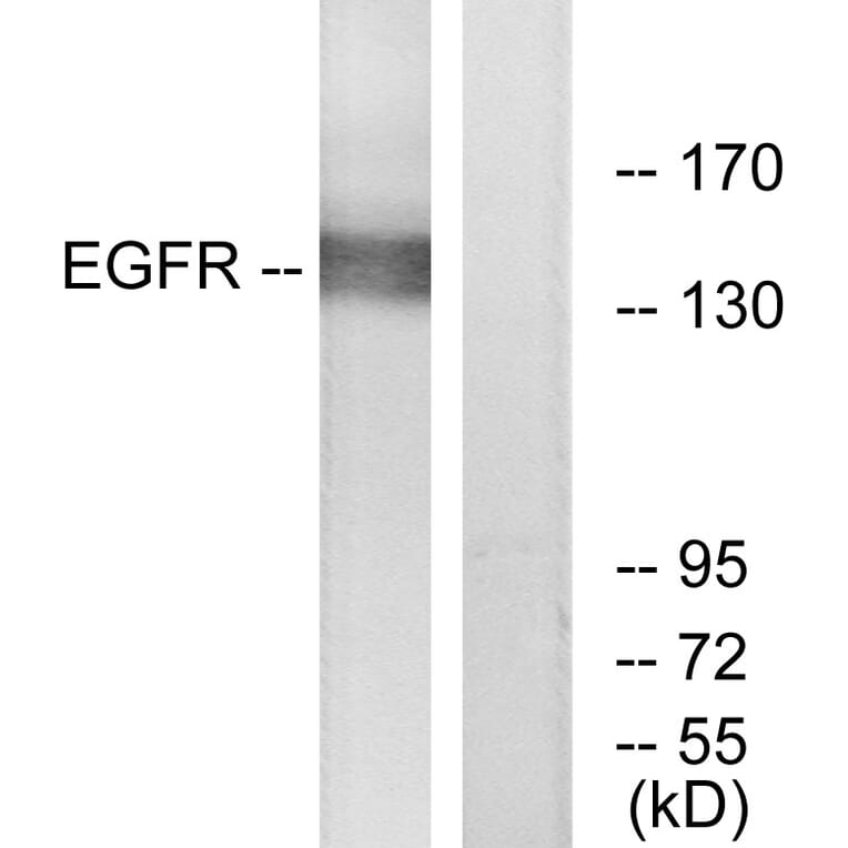 Western Blot - Anti-EGFR Antibody (B7065) - Antibodies.com