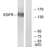 Western Blot - Anti-EGFR Antibody (B7065) - Antibodies.com