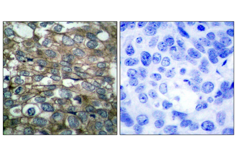 Immunohistochemistry - Anti-EGFR Antibody (B7065) - Antibodies.com