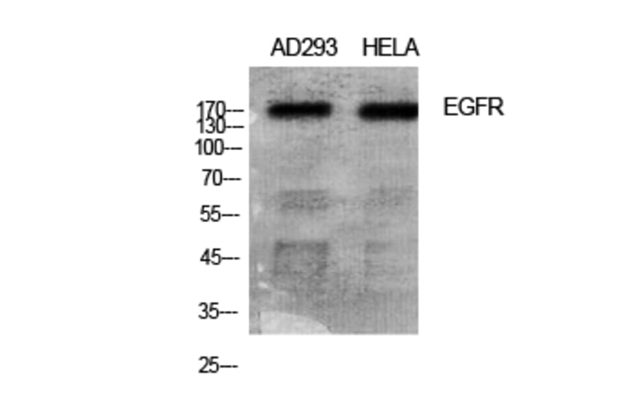 Western Blot - Anti-EGFR Antibody (B7065) - Antibodies.com