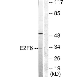 Western Blot - Anti-E2F6 Antibody (C0179) - Antibodies.com