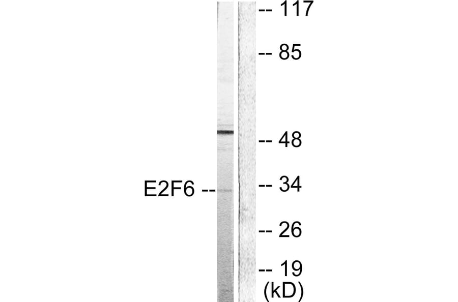 Western Blot - Anti-E2F6 Antibody (C0179) - Antibodies.com