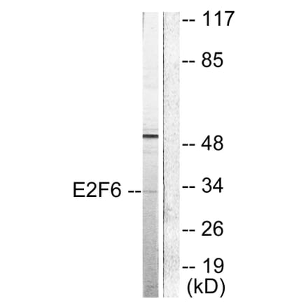 Western Blot - Anti-E2F6 Antibody (C0179) - Antibodies.com