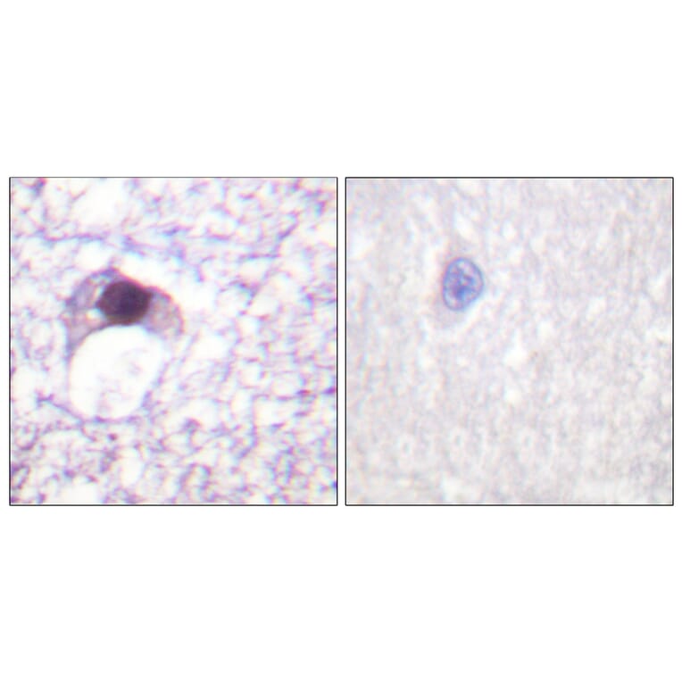 Immunohistochemistry - Anti-E2F6 Antibody (C0179) - Antibodies.com