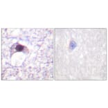 Immunohistochemistry - Anti-E2F6 Antibody (C0179) - Antibodies.com