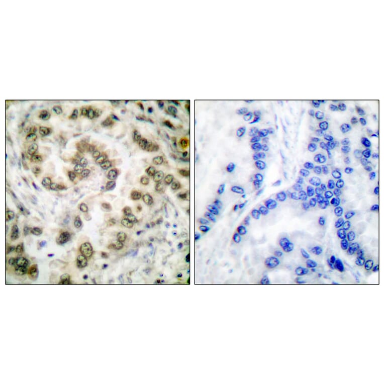 Immunohistochemistry - Anti-E2F4 Antibody (C0178) - Antibodies.com
