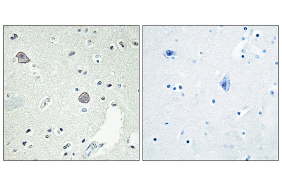 Immunohistochemistry - Anti-DRD1 Antibody (G076) - Antibodies.com